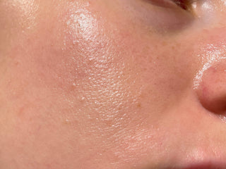 Sweat, Acne, or Both? How to Build Your Routine with CLn Cleansers Based on Your Skin Concerns